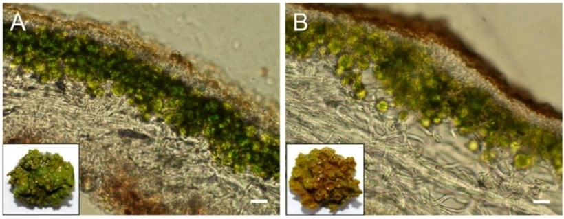 Xanthoria parietina coupe transversale thale